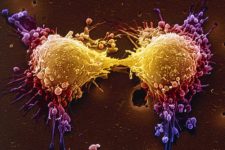 Células cancerígenas podem se autodestruírem, dizem cientistas