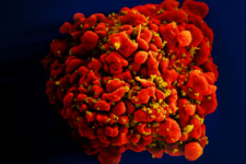 Paciente é declarado curado do HIV após receber células-tronco