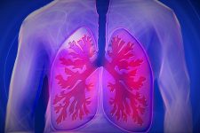 Câncer de pulmão é desafio internacional