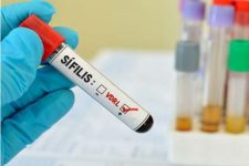 Brasil não consegue parar sífilis, casos aumentam