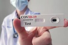 90 novos casos de Covid-19 na XI Geres