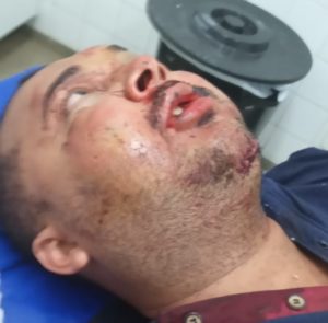 Serra-talhadense sofre acidente na PE-365 e pede ajuda