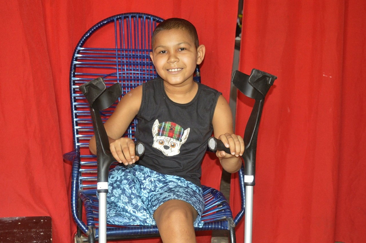 Após ter perna amputada, menino luta contra câncer em ST