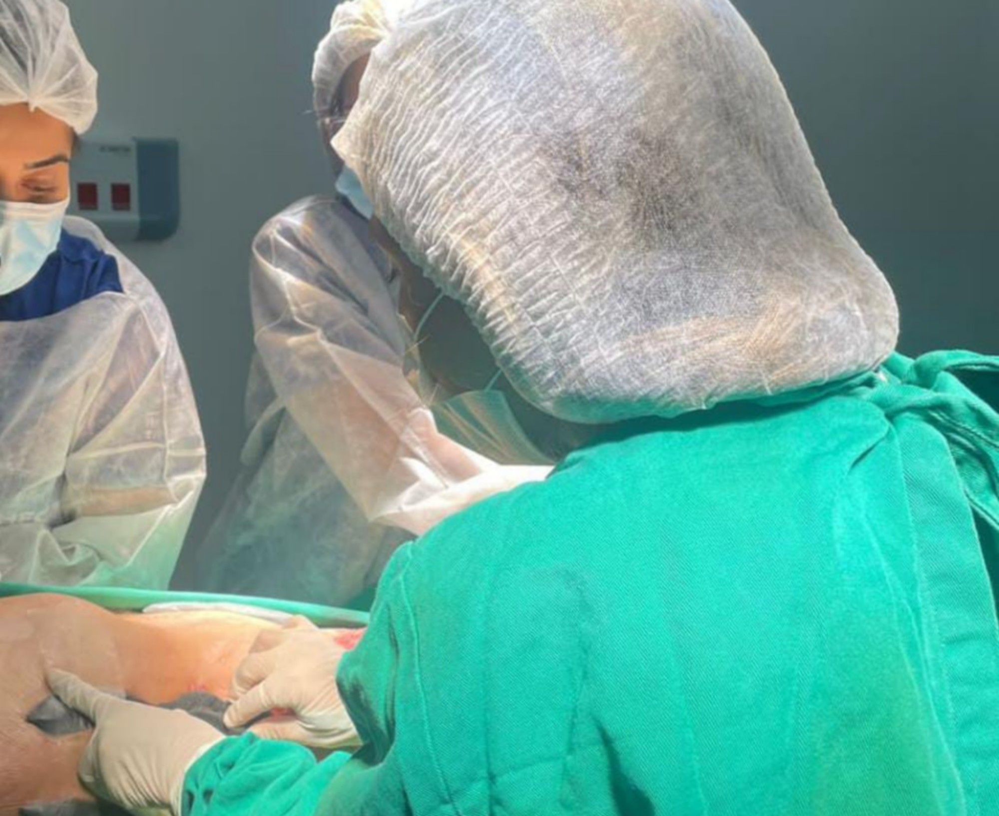 Hospital Eduardo Campos realiza procedimento pioneiro em ST