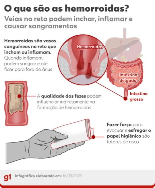 Hemorroidas: celular no banheiro favorece surgimento