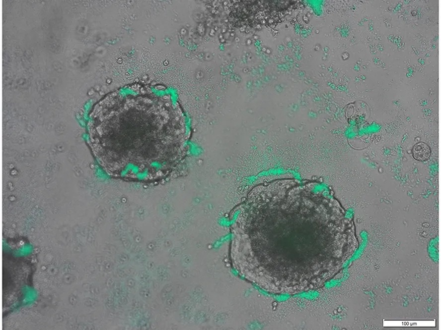 Bactérias "treinadas" poderão caçar câncer no corpo, mostra novo experimento