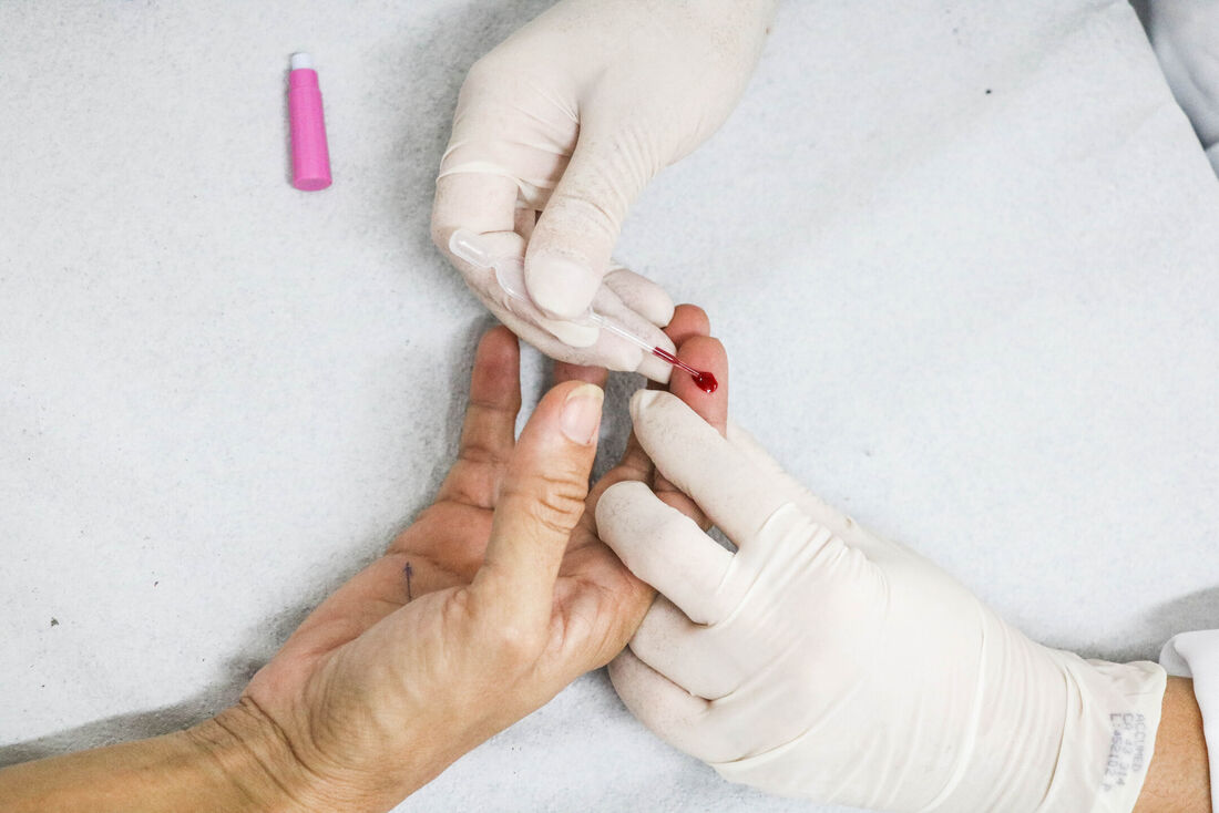 EUA recomenda pílulas para prevenção de IST