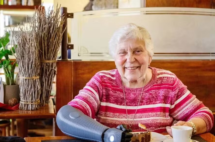 Idosa de 84 anos se torna a mulher mais velha do mundo a receber braço biônico