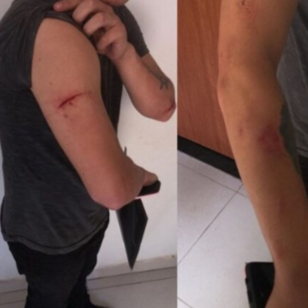 Homem vai na casa da ex e é agredido a tijoladas 1 Homem vai na casa da ex e é agredido a tijoladas