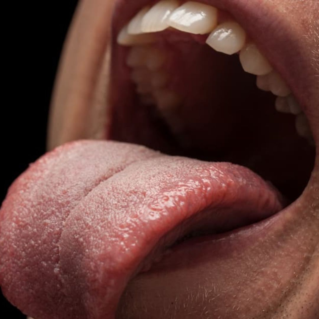 Você escova a língua? Veja os 4 ricos de infecção bacteriana se não tiver o hábito