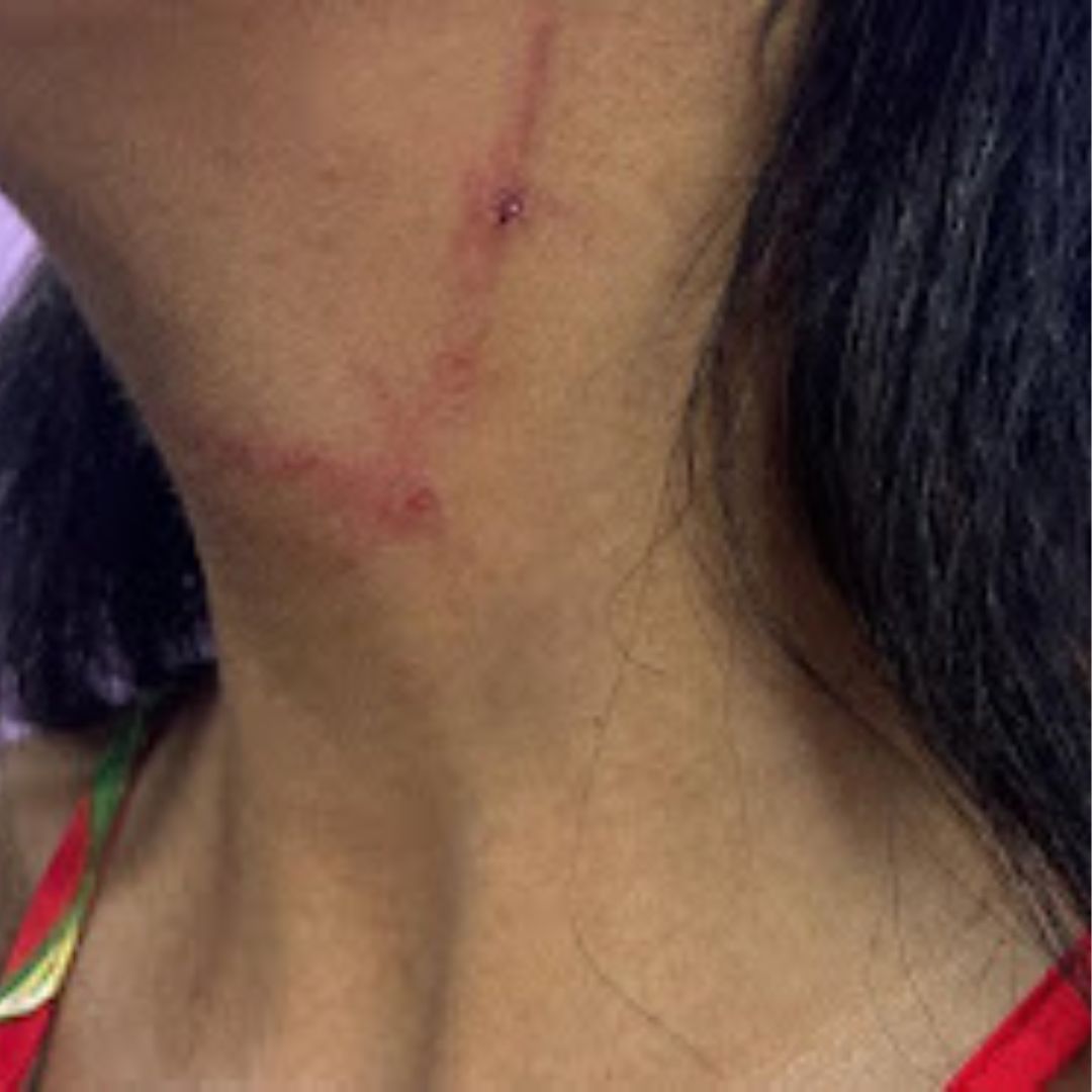 14º BPM evita tragédia entre avó e neta 1 Policiais evitam tragédia em violência de avó contra neta - Foto: Reprodução / Geo Belmonte