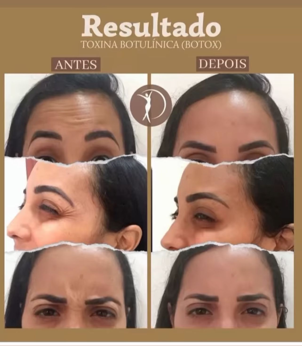 Clínica Shuenia Menezes se destaca com resultados em emagrecimento