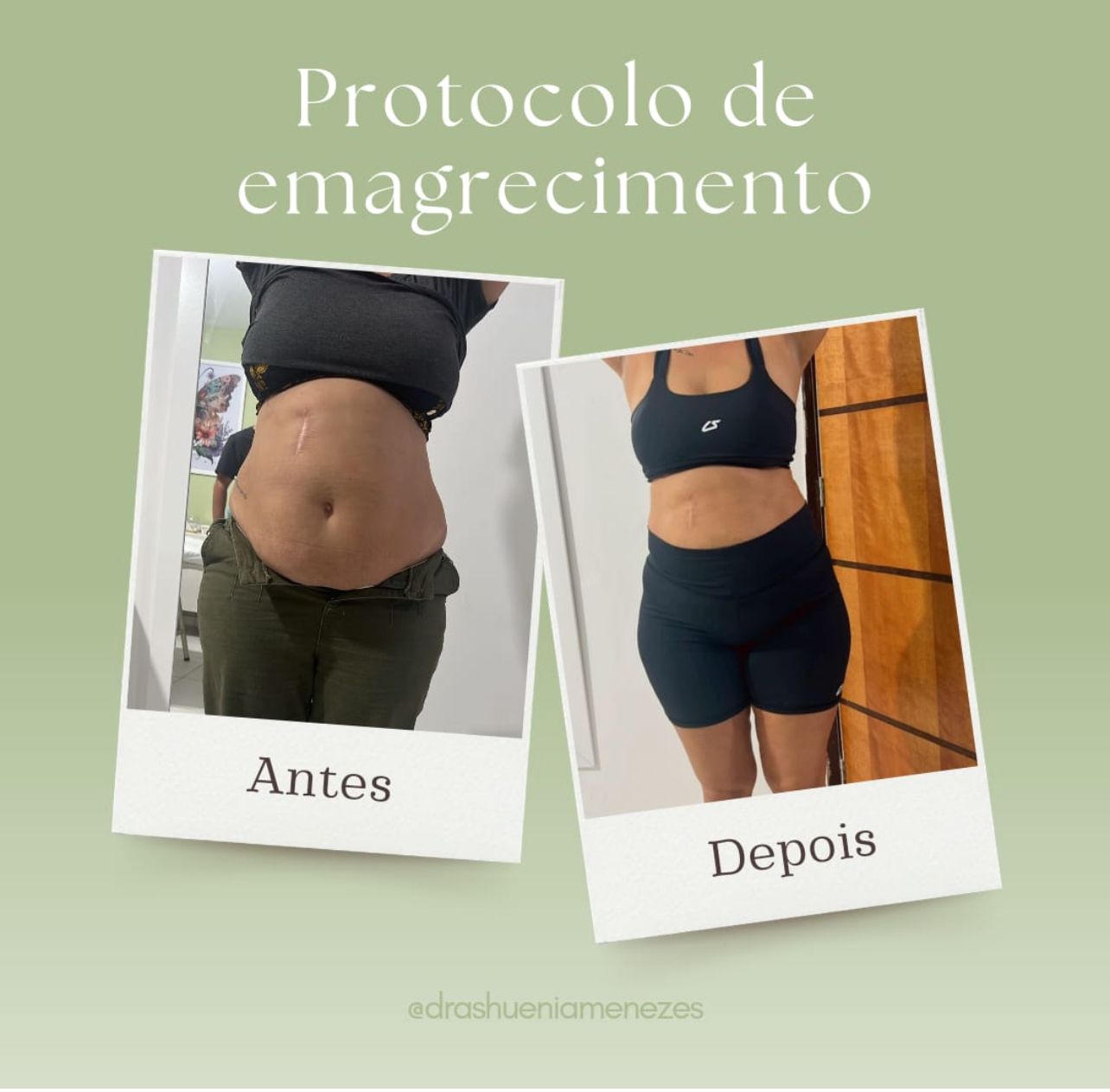 Clínica Shuenia Menezes se destaca com resultados em emagrecimento