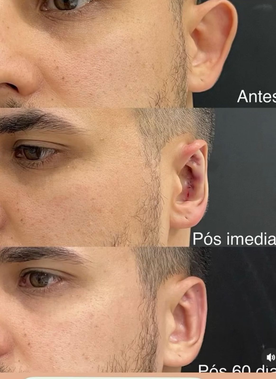 Clínica Shuenia Menezes se destaca com resultados em emagrecimento