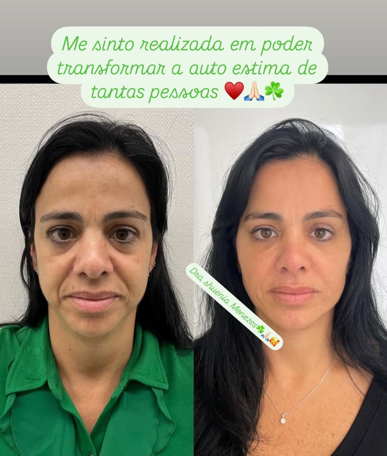 Clínica Shuenia Menezes se destaca com resultados em emagrecimento