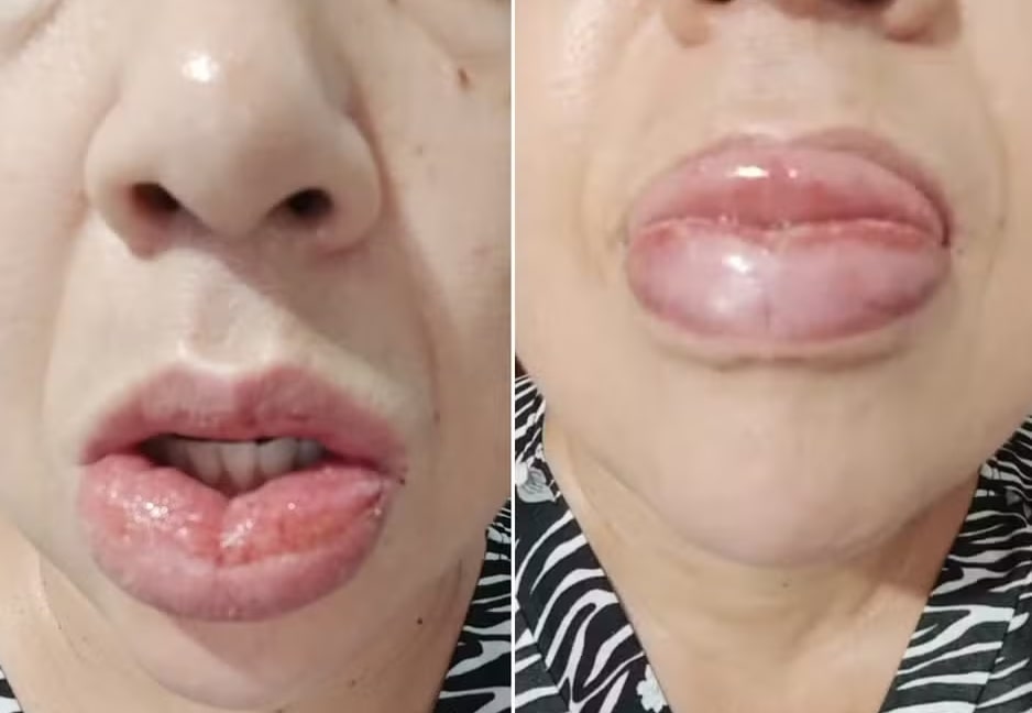 Colgate decide parar de fabricar o creme dental Clean Mint após reações alérgicas 1 Colgate decide parar de fabricar o creme dental Clean Mint após reações alérgicas - Foto: Arquivo pessoal