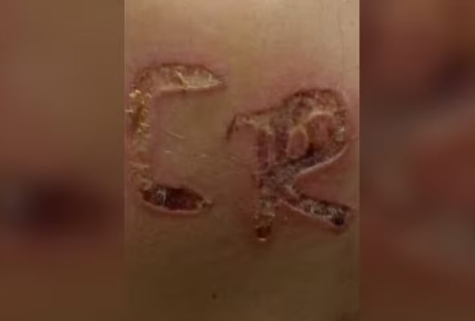 Marido é preso após marcar iniciais do nome dele no corpo da esposa 1 Marido é preso após marcar iniciais do nome dele no corpo da esposa - Foto: Divulgação / Polícia Civil