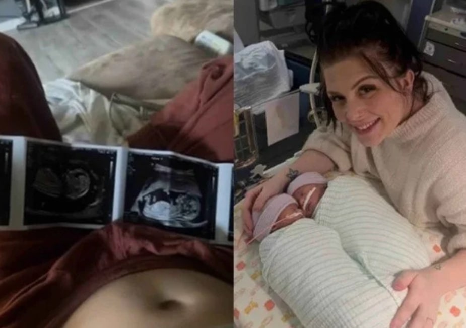 Grávida de quíntuplos faz escolha difícil para salvar a própria vida e dois dos bebês 1 Grávida de quíntuplos faz escolha difícil para salvar a própria vida e dois dos bebês - Foto: Reprodução / TikTok