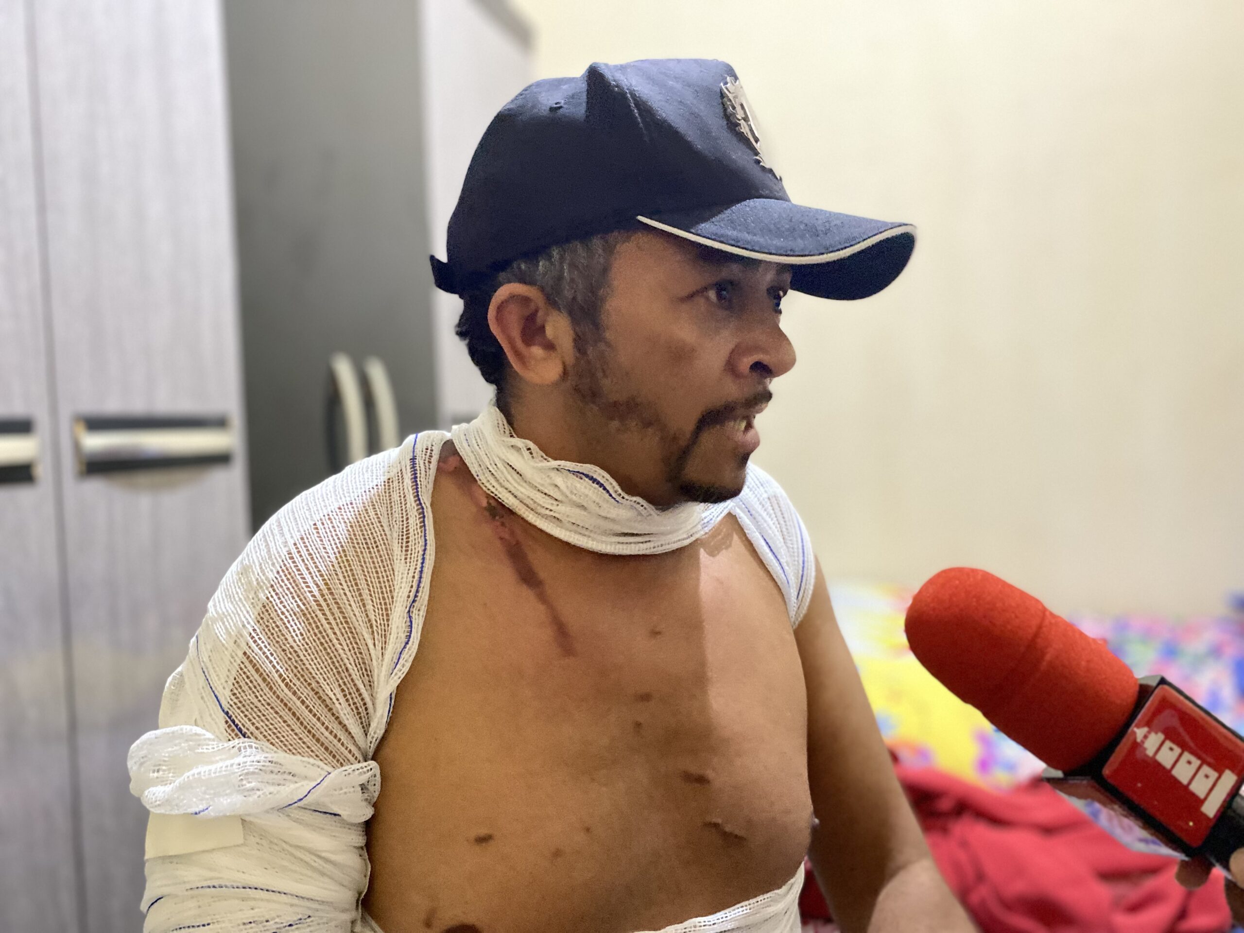Farol entrevista vítima de ataque com água fervente em Serra Talhada