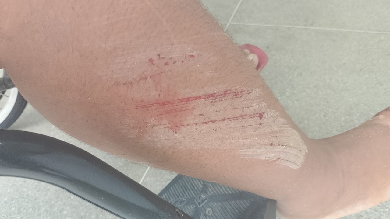 Agricultora espera consulta e exames há 3 meses após queda em via de ST