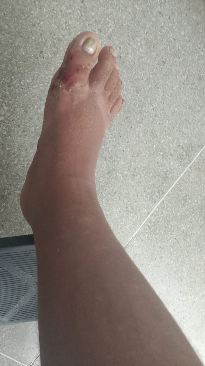 Agricultora espera consulta e exames há 3 meses após queda em via de ST