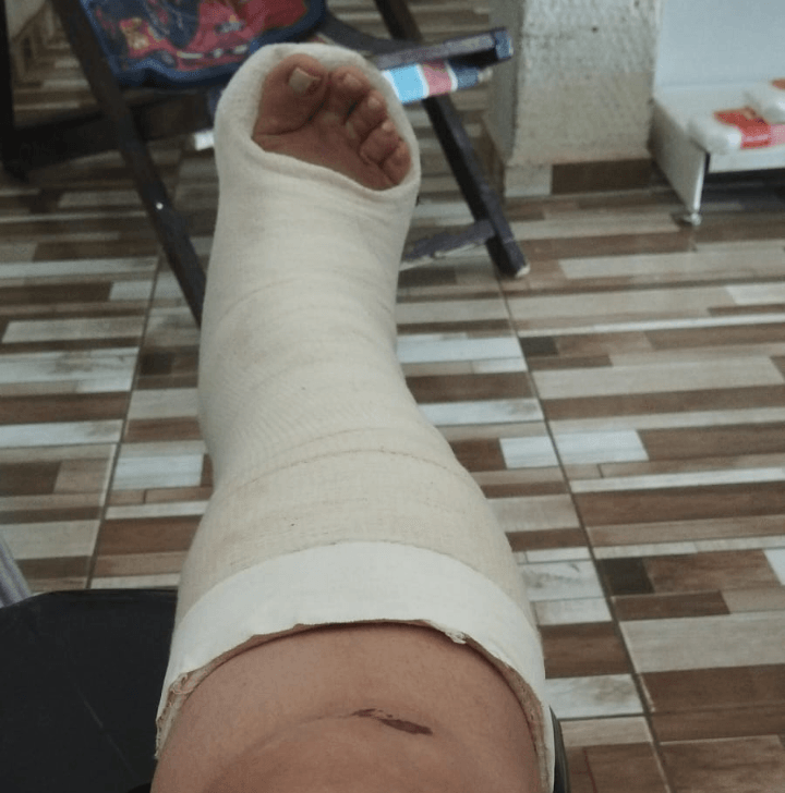 Mulher sofre ataque de cães em ST e vai ficar 45 dias sem trabalhar 1 Mulher sofre ataque de cães em ST e vai ficar 45 dias sem trabalhar