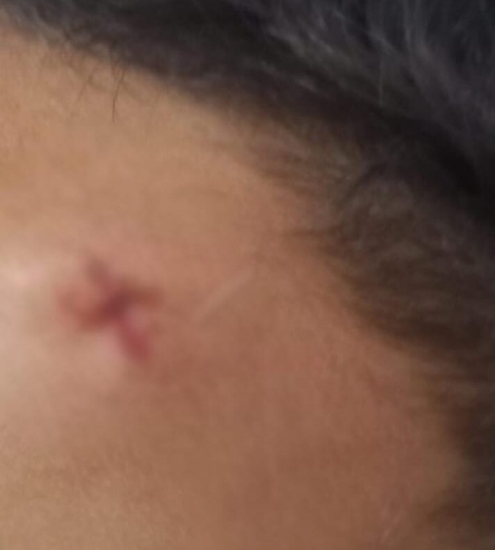 Mãe acusa escola de negligência após acidente com filho em ST