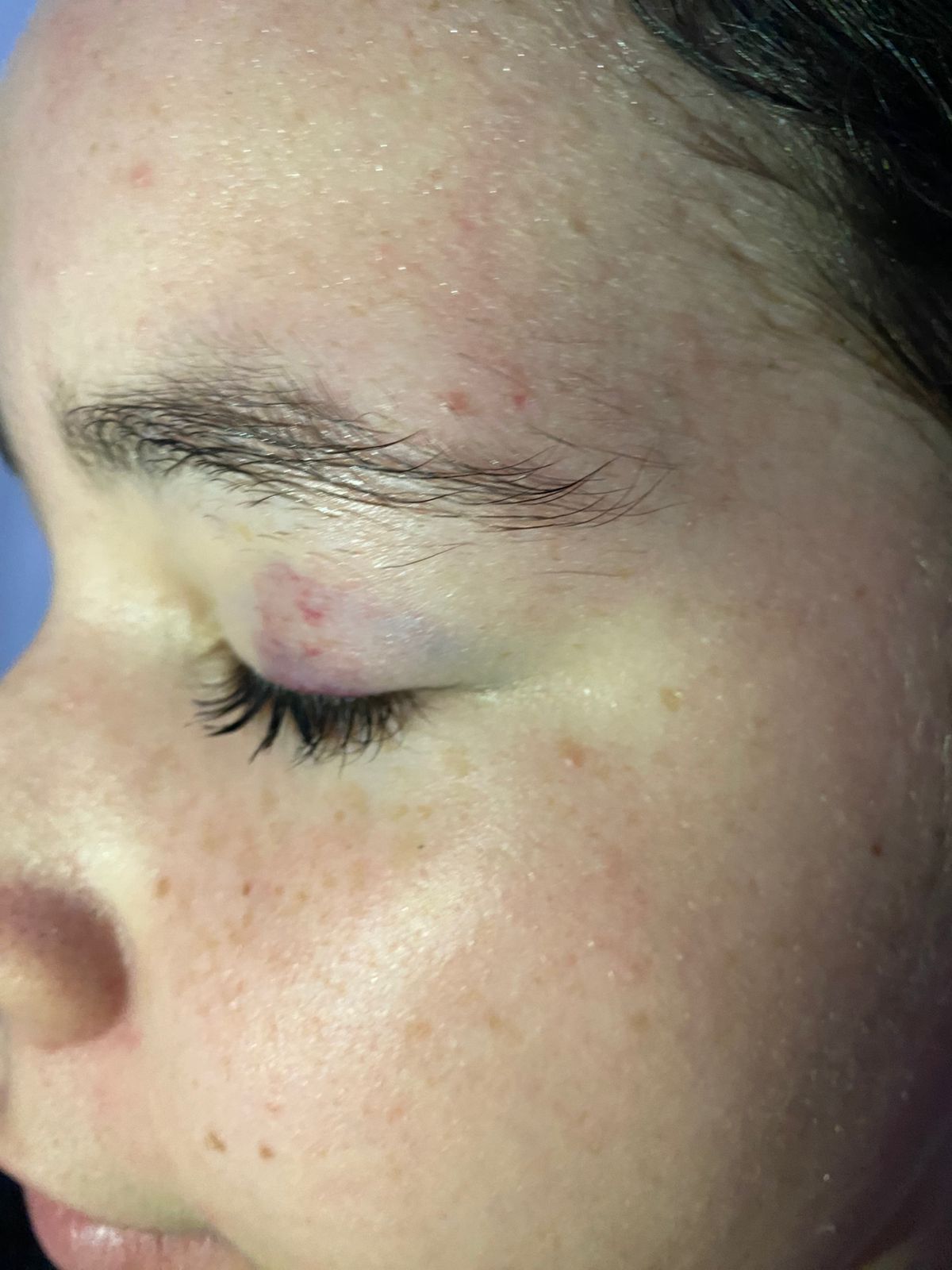 Mãe diz que filha foi agredida em escola municipal e cobra por segurança