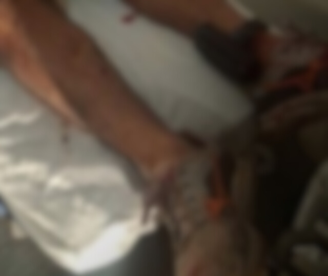 Homem é morto a tiros dentro de ambulância no Agreste