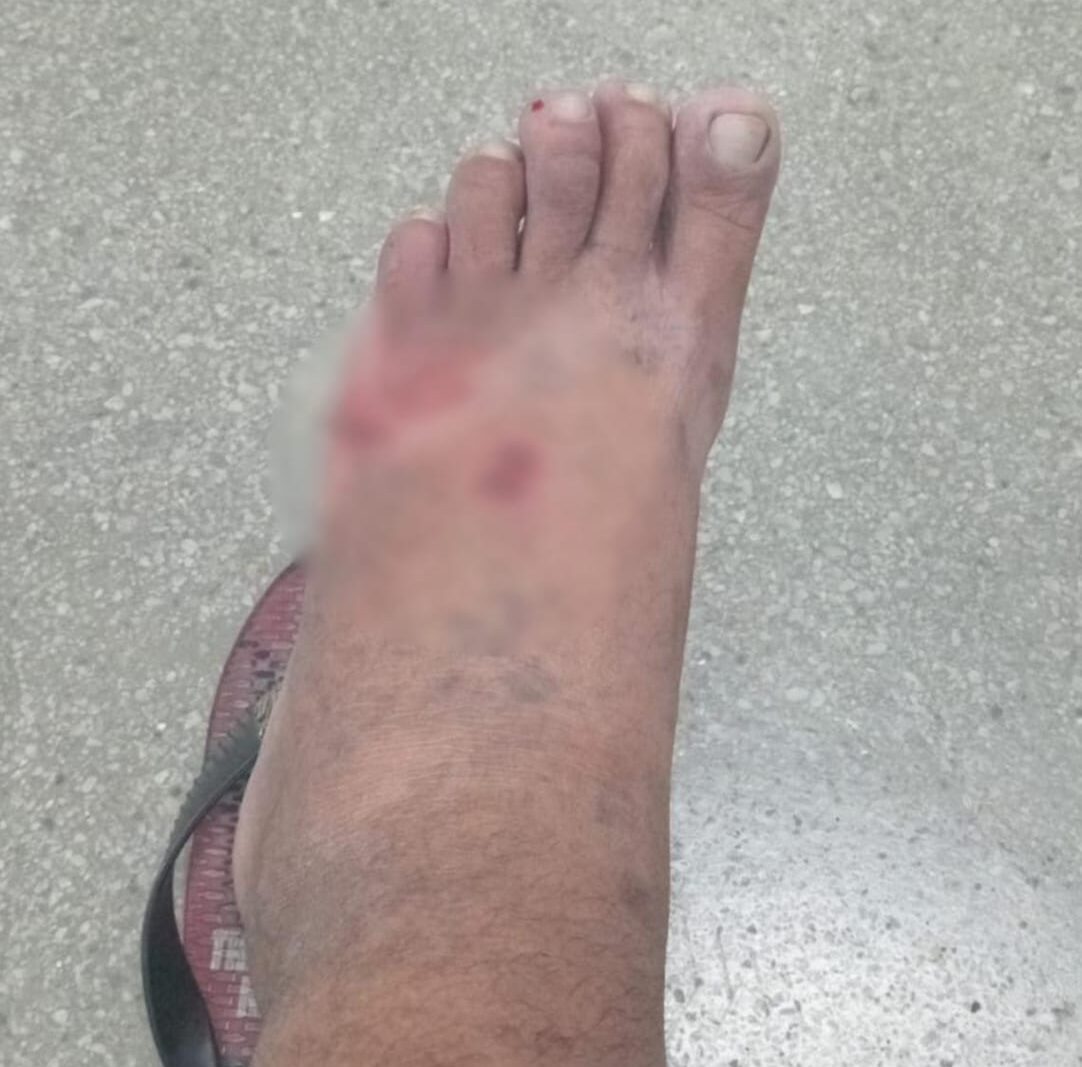 Mototaxista critica epidemia de cães em Serra Talhada após ser atacado