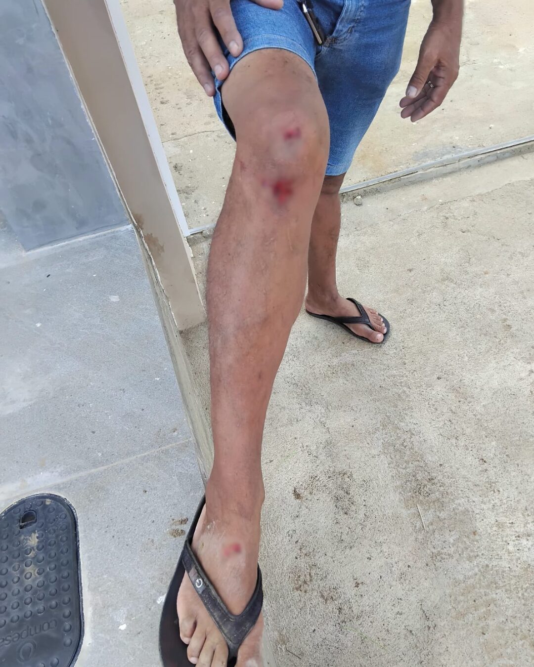 Serra Talhada registra mais um ataque de cão; homem é derrubado de moto 1 Homem fica ferido após ser derrubado da moto por cachorros de rua na AABB