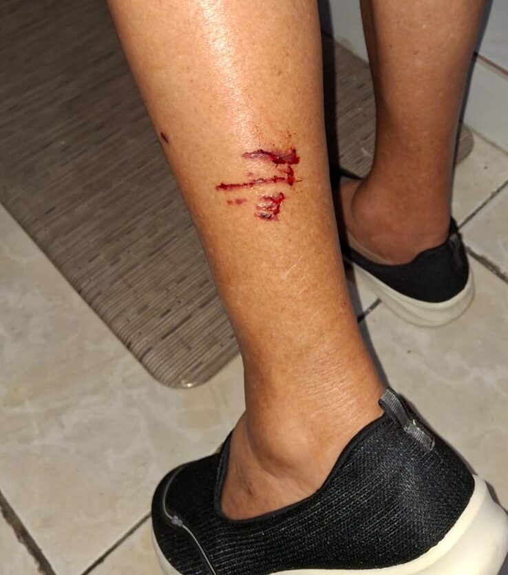 Idosa é atacada por cães de rua a caminho da Concatedral em ST 1 Idosa é atacada por cães de rua a caminho da Concatedral em ST