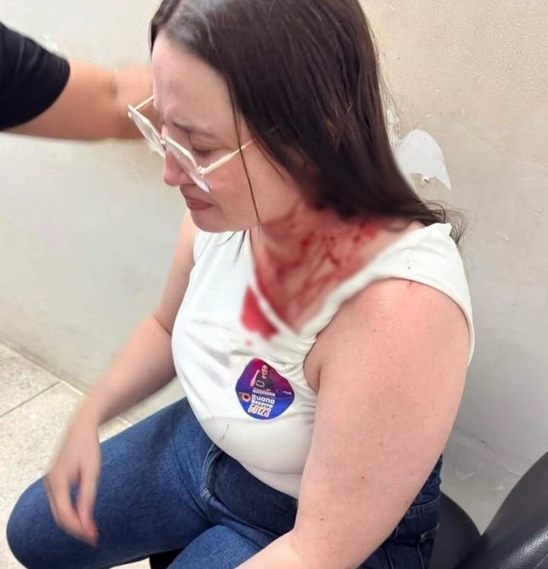 Candidata a deputada pelo PSOL é atacada em Ouricuri, no Sertão de PE 1 Candidata a deputada pelo PSOL é atacada em Ouricuri, no Sertão de PE